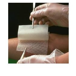 GARZA MEDICATA BACTIGRAS CON CLOREXIDINA ACETATO 0,5% 15X20CM 10 PEZZI - Farmacia Murachelli Di Putelli dr. Giovanni