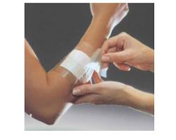 FILM ADESIVO IN POLIURETANO IN ROTOLO TRASPARENTE IMPERMEABILE PER FISSAGGIO DI MEDICAZIONI E CATETERI 10X1000CM 1 PEZZO - Farmacia Murachelli Di Putelli dr. Giovanni